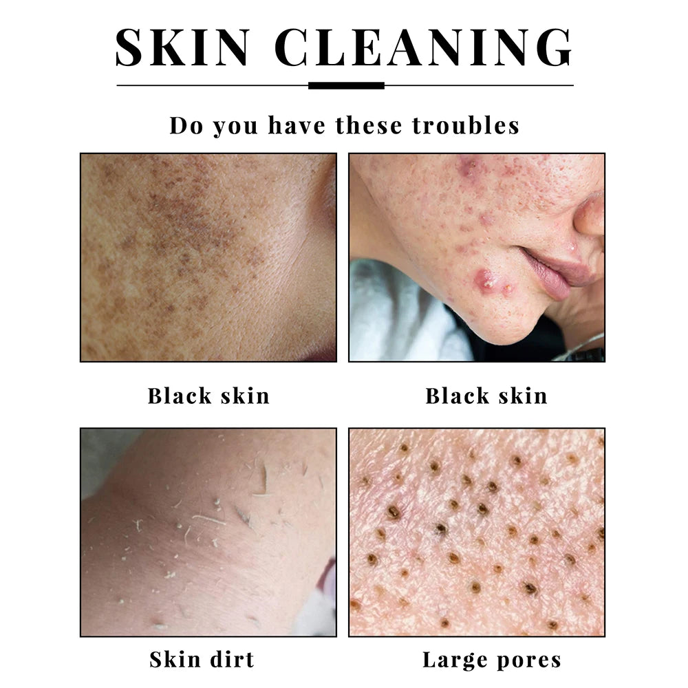 Naturalne mydło z kwasem kojowym – zestaw 2 sztuk